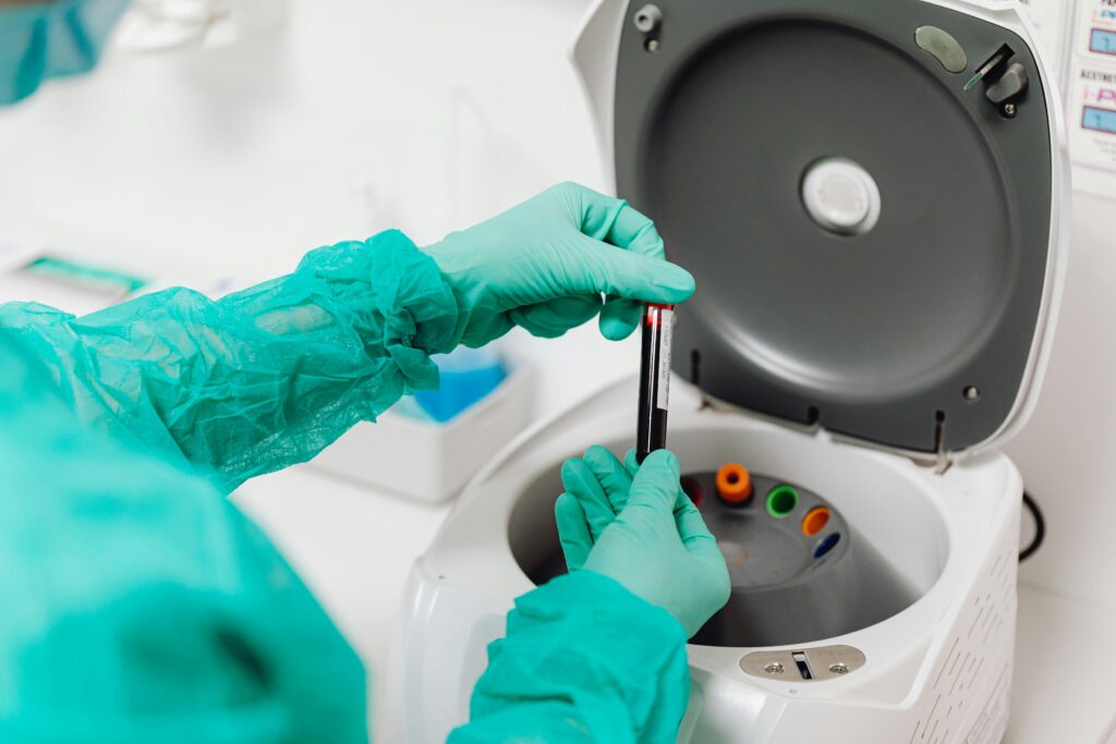 PRP (Platelet-Rich Plasma) PRP (Platelet-Rich Plasma)