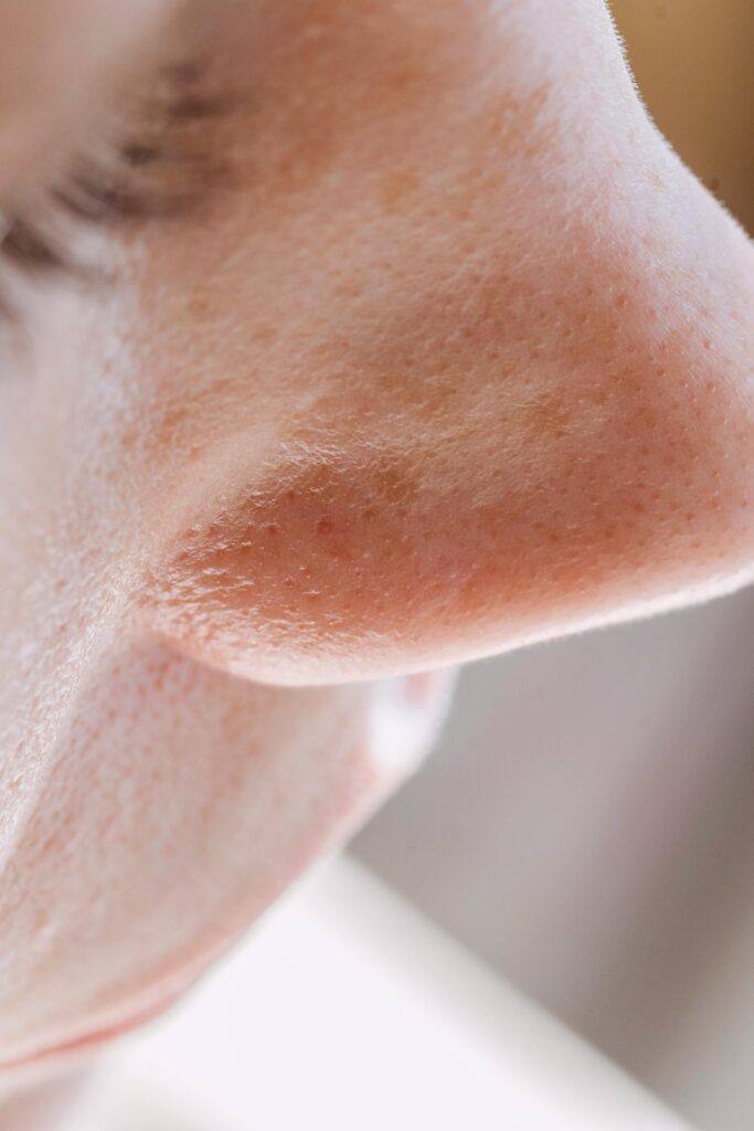 Detailed close-up of a human nose highlighting pores and skin texture, showcasing natural beauty.